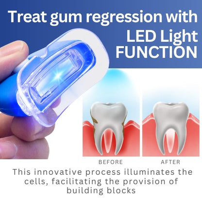 AEXZR­™ LED Light Gum Repair