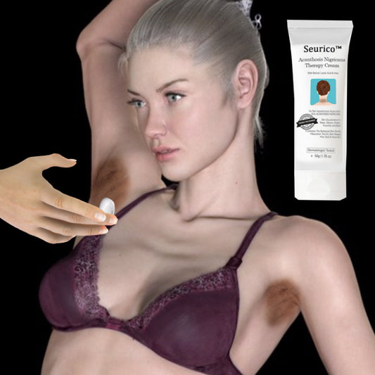 AEXZR™ Acanthosis Nigricans Hyperpigmentation Therapy Cream - Sale up to 80% Off!